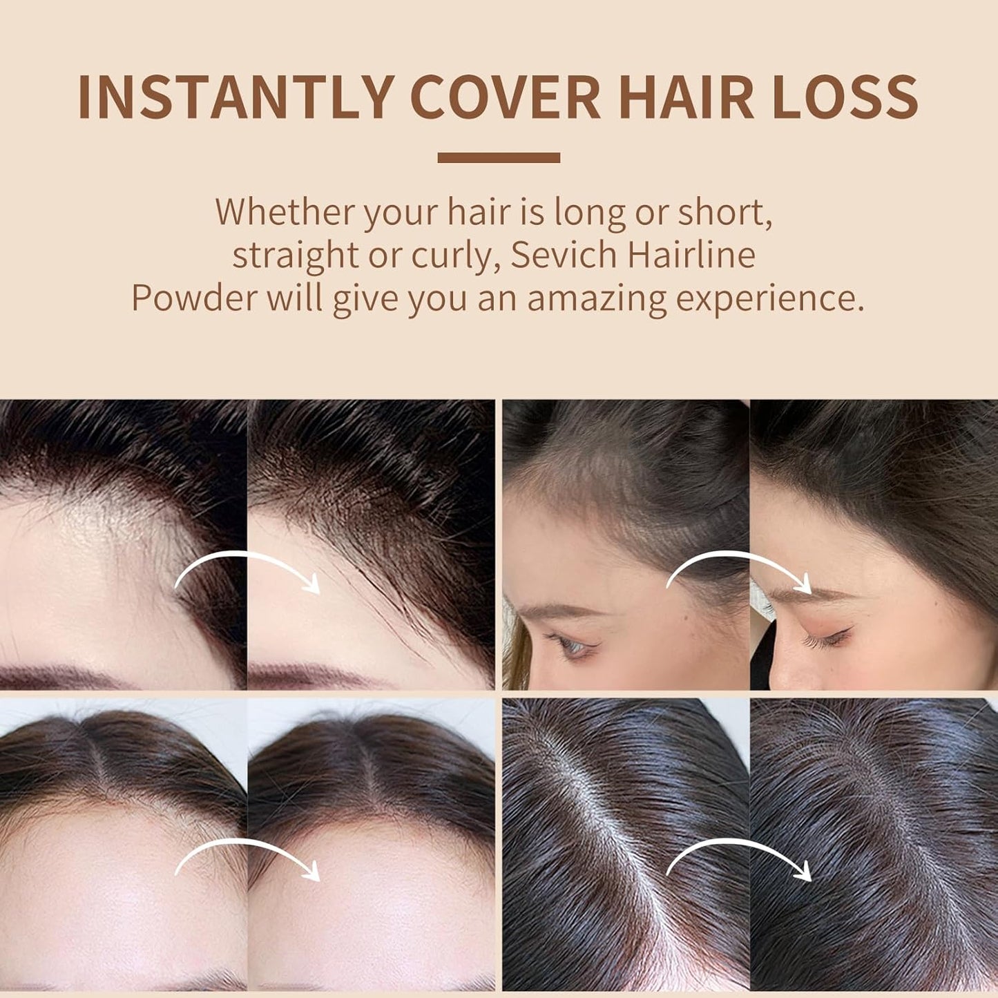 Sevich Hairline Powder,Instantly Conceals Hair Loss, Root Touch up Powder, Hair Shadow Toppers for Women & Men, Touch Up for Thinning Gray Hair, Windproof & Sweatproof, Dark Brown